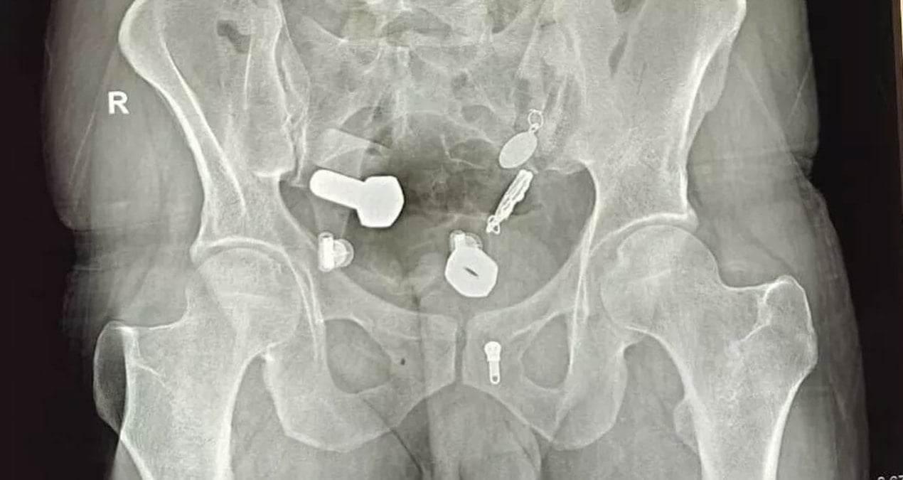 midesi nalbura donmus karin agrisiyla gittigi doktorda gercek ortaya cikti u9gC2Rat.jpg